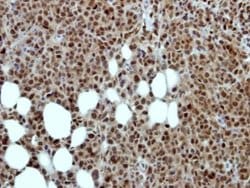 Invitrogen MED17 Polyclonal Antibody 100 &mu;L; Unconjugated:Antibodies,