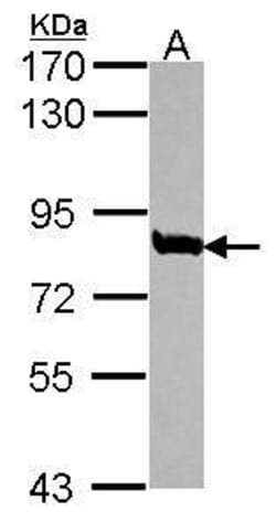 Invitrogen MED17 Polyclonal Antibody 100 &mu;L; Unconjugated:Antibodies,