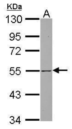 Invitrogen SAB Polyclonal Antibody 100 &mu;L; Unconjugated:Antibodies,