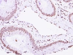 Invitrogen VPS4B Polyclonal Antibody 100 &mu;L; Unconjugated:Antibodies,