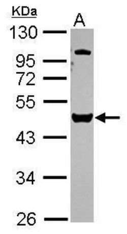 Invitrogen VPS4B Polyclonal Antibody 100 &mu;L; Unconjugated:Antibodies,