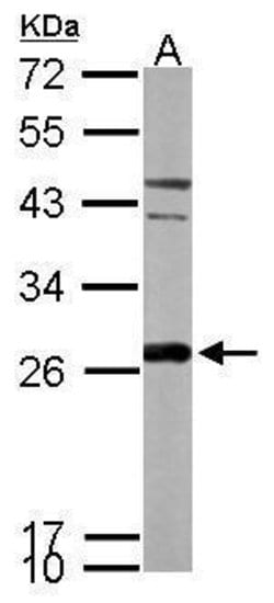 Invitrogen PRDX6 Polyclonal Antibody 100 &mu;L | Buy Online | Invitrogen&trade; | Fisher Scientific