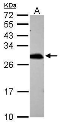 Invitrogen PRDX6 Polyclonal Antibody 100 &mu;L | Buy Online | Invitrogen&trade; | Fisher Scientific