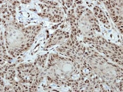 Invitrogen CTR9 Polyclonal Antibody 100 &mu;L; Unconjugated:Antibodies,