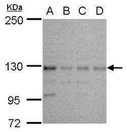 Invitrogen CTR9 Polyclonal Antibody 100 &mu;L; Unconjugated:Antibodies,