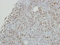 Invitrogen SAFB2 Polyclonal Antibody 100 &mu;L | Buy Online | Invitrogen&trade; | Fisher Scientific