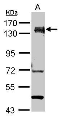 Invitrogen PUM1 Polyclonal Antibody 100 &mu;L; Unconjugated:Antibodies,