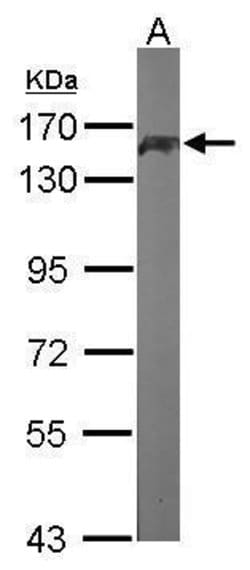 Invitrogen PUM1 Polyclonal Antibody 100 &mu;L; Unconjugated:Antibodies,