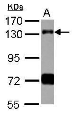 RNF40 Polyclonal Antibody:Antibodies, Polyclonal