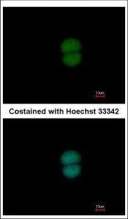 Invitrogen RNF40 Polyclonal Antibody 100 μL; Unconjugated:Antibodies,
