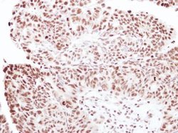 Invitrogen RNF40 Polyclonal Antibody 100 μL; Unconjugated:Antibodies,