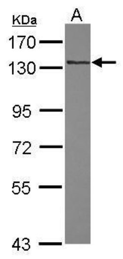 Invitrogen RNF40 Polyclonal Antibody 100 μL; Unconjugated:Antibodies,