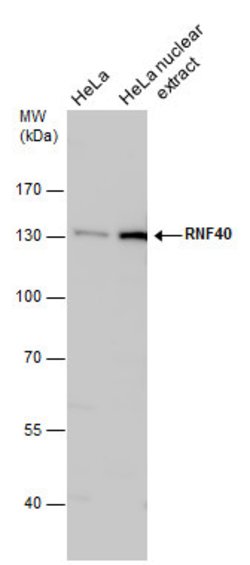 Invitrogen RNF40 Polyclonal Antibody 100 μL; Unconjugated:Antibodies,