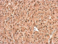 PSMD6 Polyclonal Antibody:Antibodies, Polyclonal