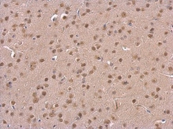 PSMD6 Polyclonal Antibody:Antibodies, Polyclonal