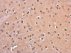 PSMD6 Polyclonal Antibody:Antibodies, Polyclonal
