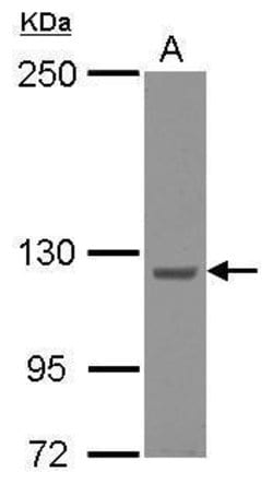 Invitrogen KIAA0196 Polyclonal Antibody 100 μL; Unconjugated:Antibodies,