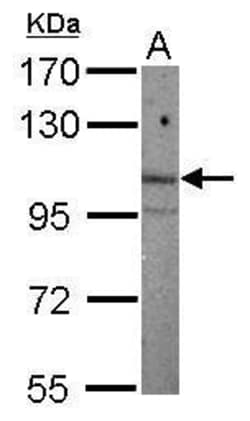 Invitrogen ARNT2 Polyclonal Antibody 100 &mu;L | Buy Online | Invitrogen&trade; | Fisher Scientific