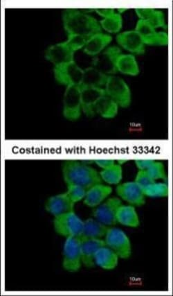 Invitrogen RNF10 Polyclonal Antibody 100 &mu;L | Buy Online | Invitrogen&trade; | Fisher Scientific