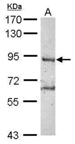 Invitrogen RNF10 Polyclonal Antibody 100 &mu;L | Buy Online | Invitrogen&trade; | Fisher Scientific
