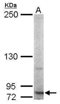 Invitrogen RNF10 Polyclonal Antibody 100 &mu;L | Buy Online | Invitrogen&trade; | Fisher Scientific