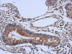Invitrogen DGCR2 Polyclonal Antibody 100 &mu;L; Unconjugated:Antibodies,