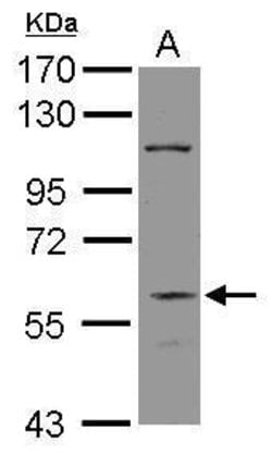 Invitrogen DGCR2 Polyclonal Antibody 100 &mu;L; Unconjugated:Antibodies,