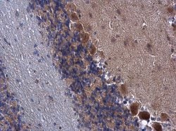 FARSB Polyclonal Antibody:Antibodies, Polyclonal
