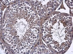 FARSB Polyclonal Antibody:Antibodies, Polyclonal