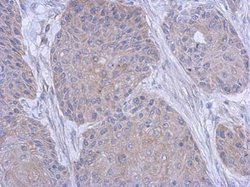 FARSB Polyclonal Antibody:Antibodies, Polyclonal
