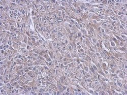 FARSB Polyclonal Antibody:Antibodies, Polyclonal