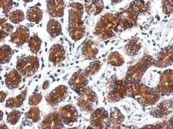 Invitrogen ARPC5 Polyclonal Antibody 100 &mu;L; Unconjugated:Antibodies,