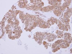 Invitrogen ACTR1B Polyclonal Antibody 100 &mu;L; Unconjugated:Antibodies,