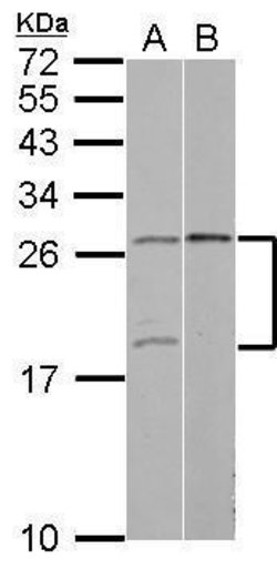 Invitrogen YAF2 Polyclonal Antibody 100 &mu;L; Unconjugated:Anticuerpos