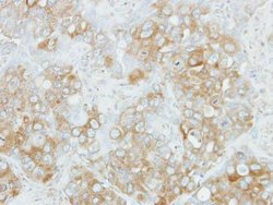 Invitrogen CALCOCO2 Polyclonal Antibody 100 &mu;L; Unconjugated:Antibodies,