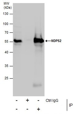 Invitrogen CALCOCO2 Polyclonal Antibody 100 &mu;L; Unconjugated:Antibodies,
