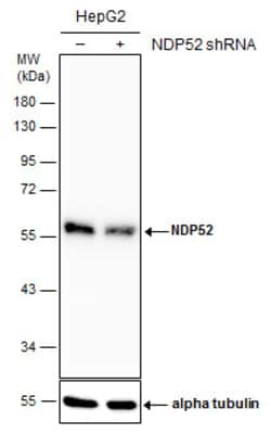 Invitrogen CALCOCO2 Polyclonal Antibody 100 &mu;L; Unconjugated:Antibodies,