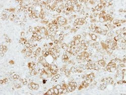 Sigma-1 Receptor Polyclonal Antibody:Antibodies, Polyclonal