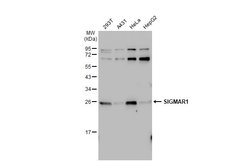 Sigma-1 Receptor Polyclonal Antibody:Antibodies, Polyclonal