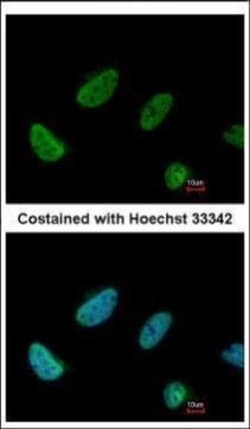 Invitrogen BCAS2 Polyclonal Antibody 100 &mu;L | Buy Online | Invitrogen&trade; | Fisher Scientific