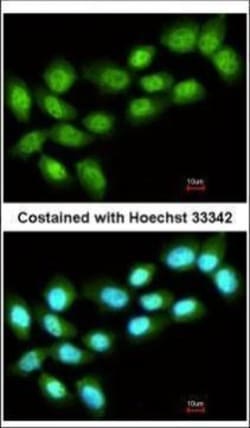 Invitrogen PRMT5 Polyclonal Antibody 100 &mu;L; Unconjugated:Anticuerpos