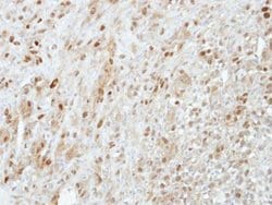 Invitrogen PRMT5 Polyclonal Antibody 100 &mu;L; Unconjugated:Anticuerpos