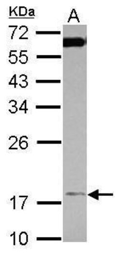 Invitrogen TIM17 Polyclonal Antibody 100 μL; Unconjugated:Antibodies,