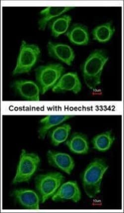 Invitrogen Dynactin 2 Polyclonal Antibody 100 &mu;L; Unconjugated:Antibodies,