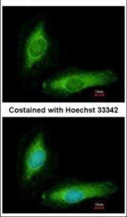 Invitrogen SCGN Polyclonal Antibody 100 &mu;L; Unconjugated:Antibodies,
