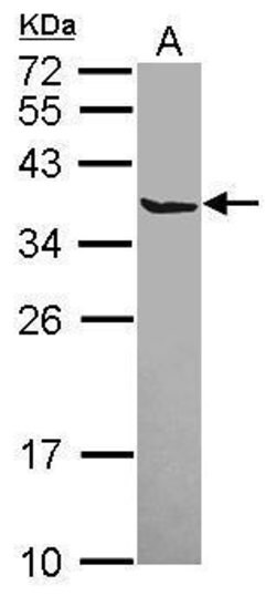 Invitrogen SCGN Polyclonal Antibody 100 &mu;L; Unconjugated:Antibodies,