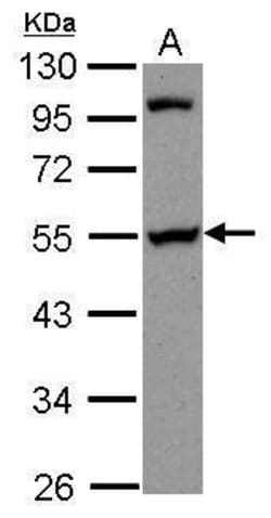 PAIP1 Polyclonal Antibody:Antibodies, Polyclonal