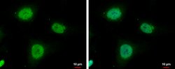 Invitrogen IGF2BP3 Polyclonal Antibody 100 &mu;L; Unconjugated:Antibodies,