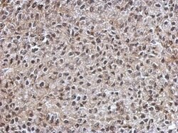 Invitrogen IGF2BP3 Polyclonal Antibody 100 &mu;L; Unconjugated:Antibodies,