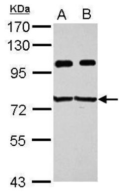 Invitrogen IGF2BP3 Polyclonal Antibody 100 &mu;L; Unconjugated:Antibodies,